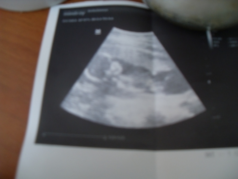 Сходили на узи