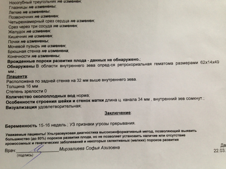 Ну вот снова была на Узи