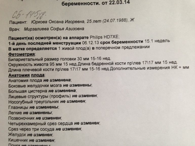 Ну вот снова была на Узи