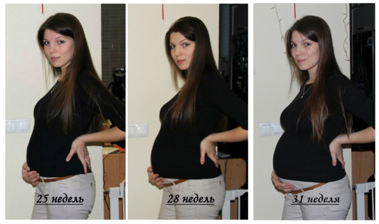 Ровно 31 неделька 26.12.13