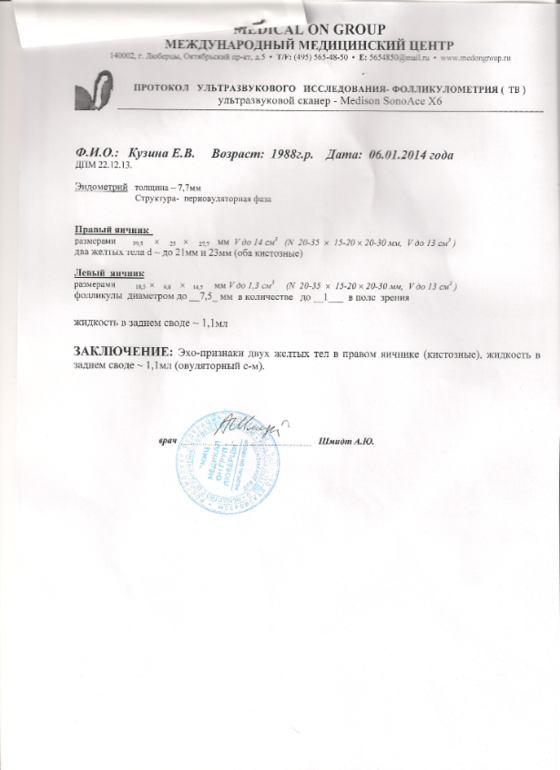 Прокоментируйсте ПОЖАЛУЙСТА МОИ УЗИ!
