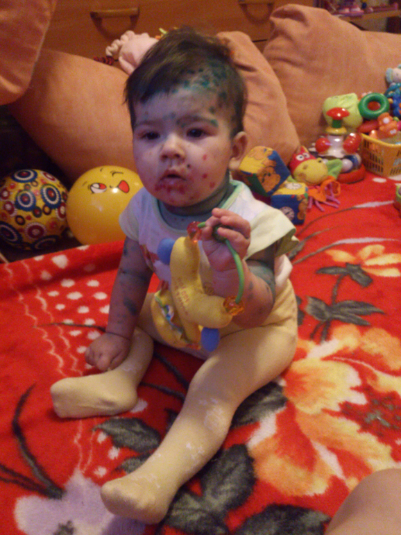 Мы ее победили или осталось тольк отмыться....ветрянка. День 6