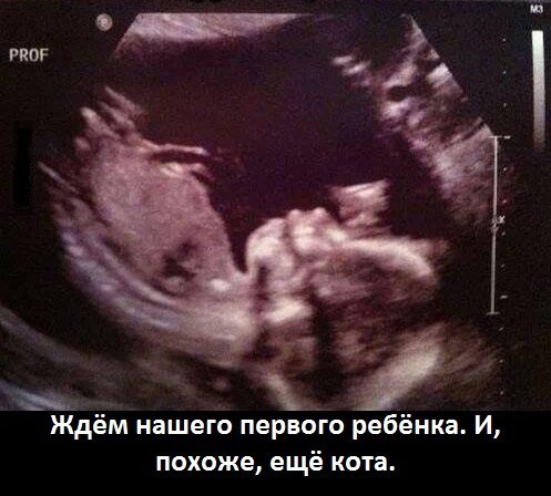 )))