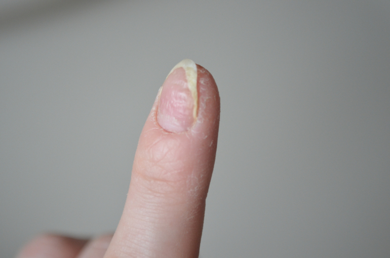 Что может быть с пальцем? Может у кого было