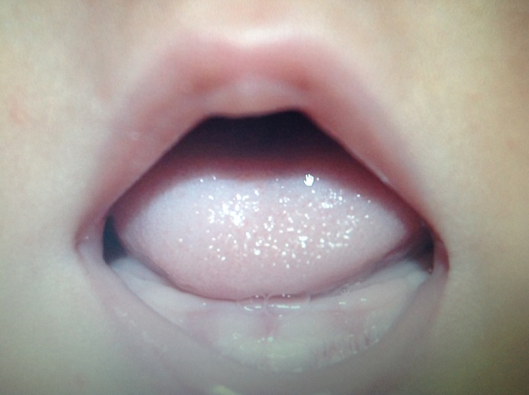 Что это может быть?????