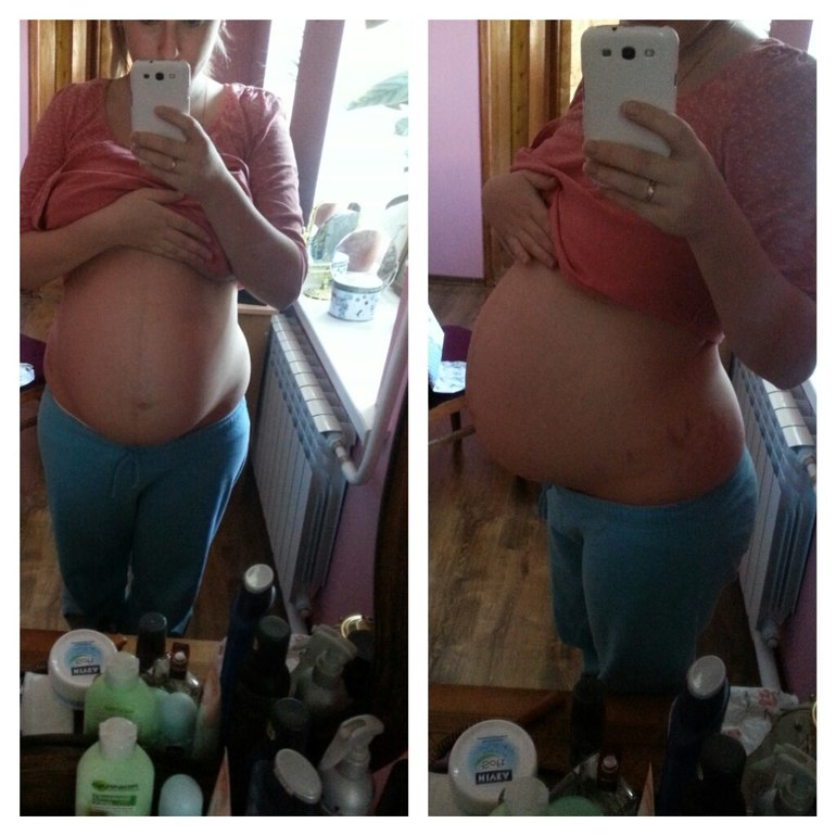 Опустился животик?