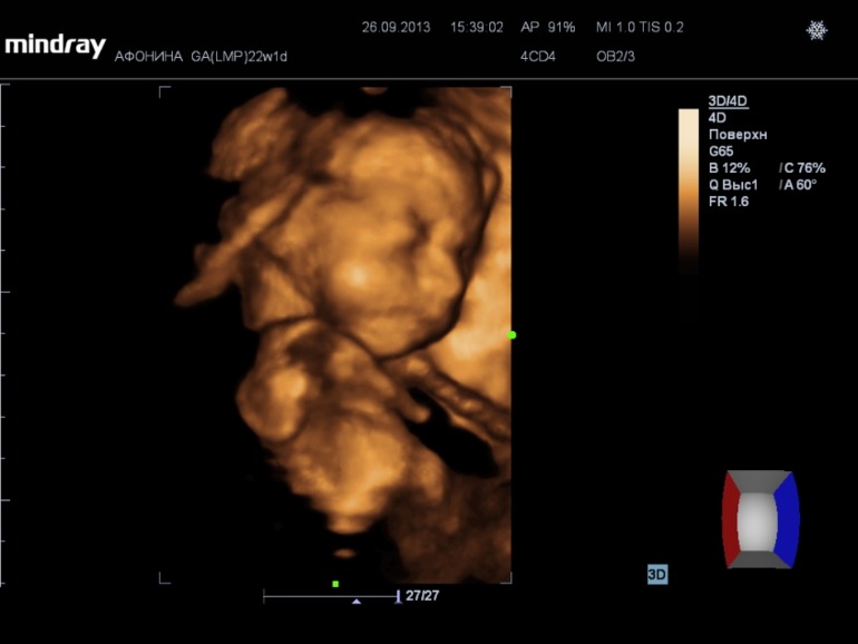 Наши супер-результаты узи)))