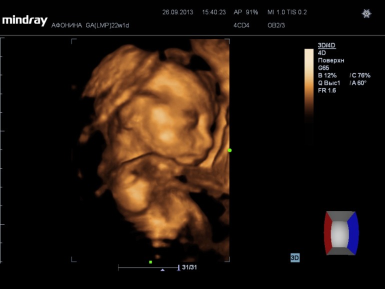 Наши супер-результаты узи)))