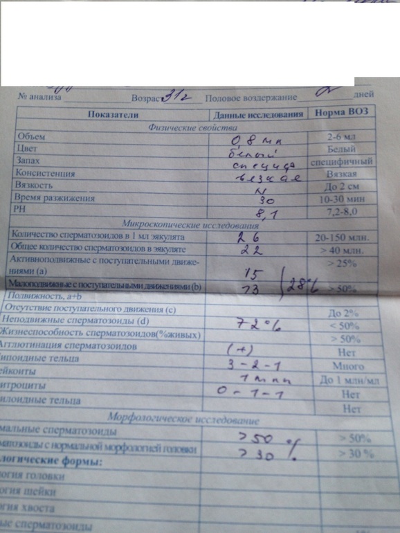 Спермограмма, нужна помощь