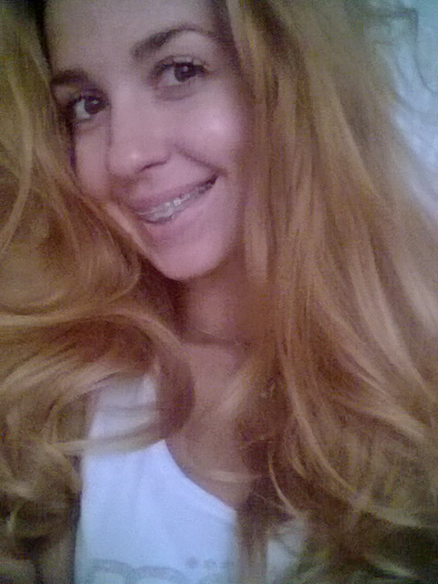 Напишу про свои брекеты.