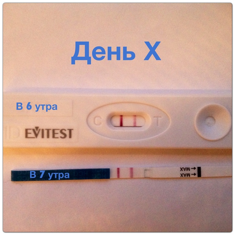15 дпо!!! День Х!!!! Тттттттттт слава богу мы растем как надо!!!!!
