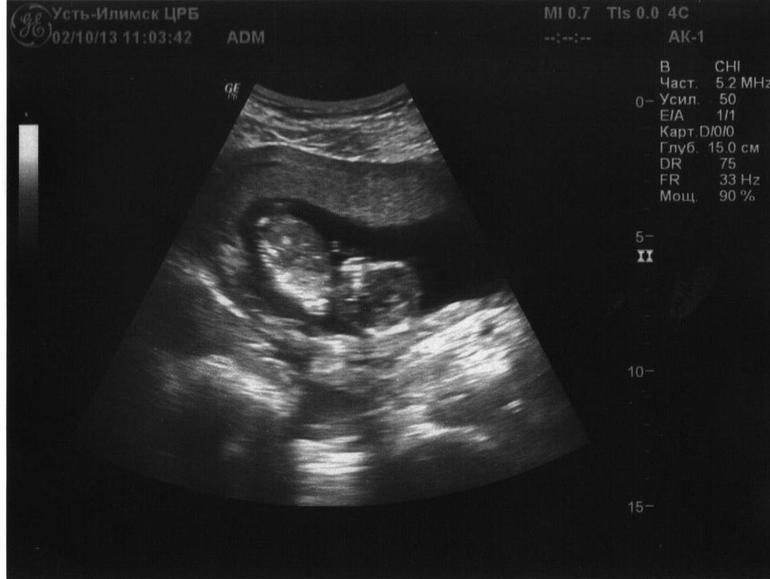 Не было бы счастья))