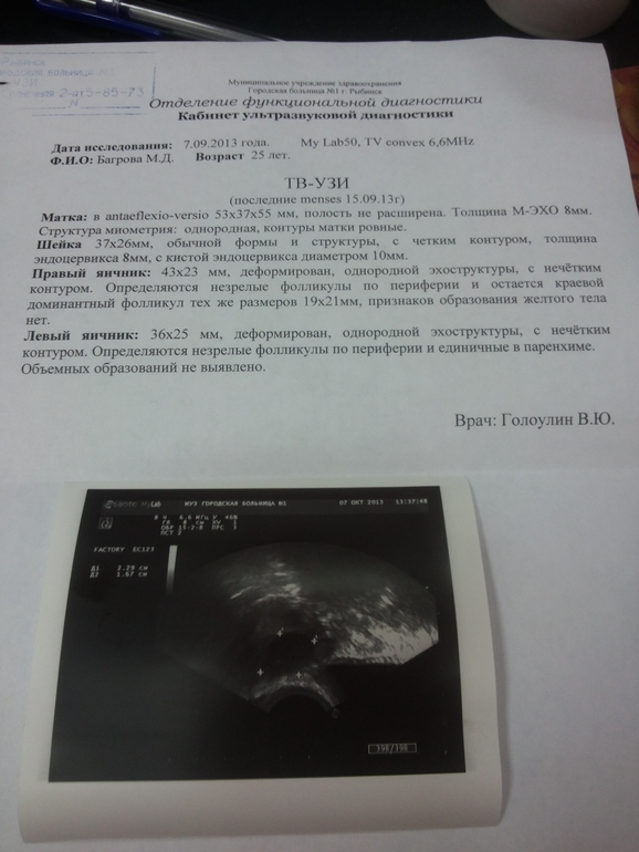 Приехала с УЗи ....растроена-это мало сказано....
