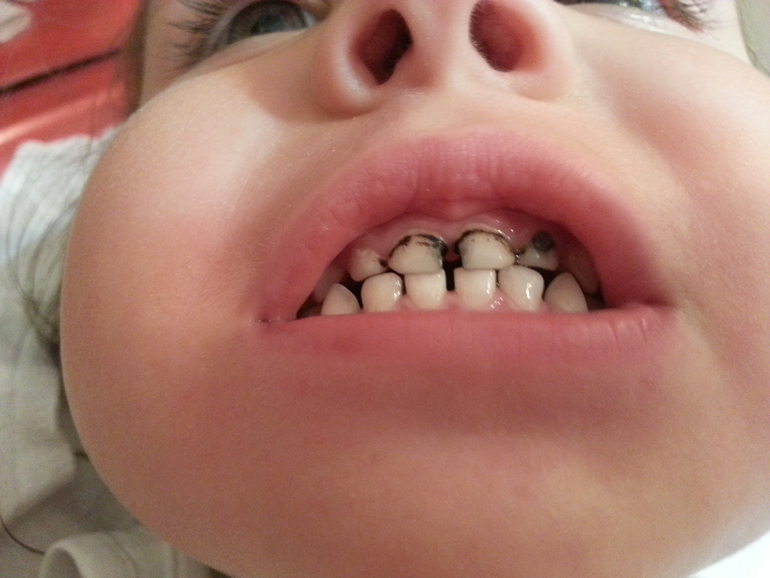 Очень прошу о консультации