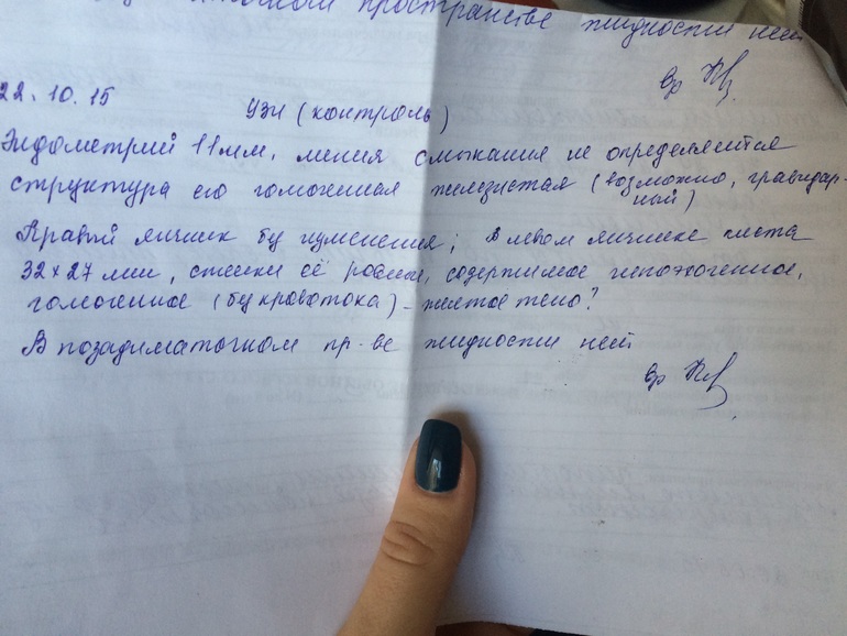 Не болит широчайшая мышца