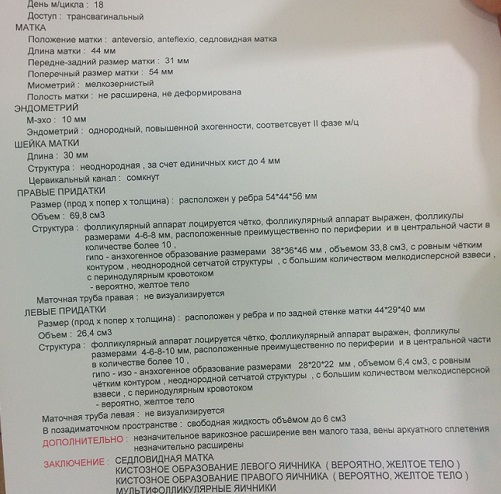 560d785a967ddc15ec8a12b98531fe25.jpg