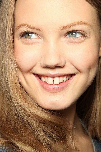 Щели между зубами