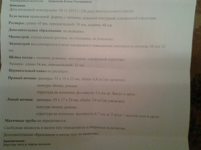 Узи на 20 ДЦ.