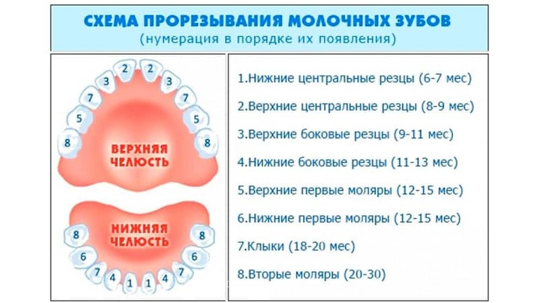 Ретенция зубов - Разновидности | Устранение аномалии