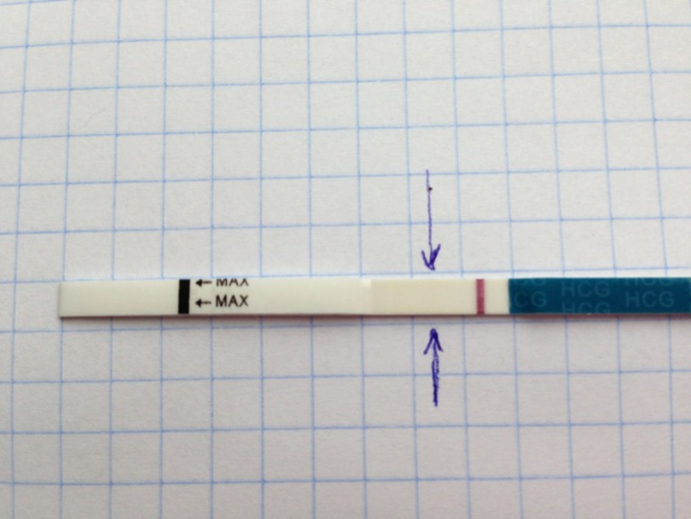 9 дпо или 7/8 дпо)