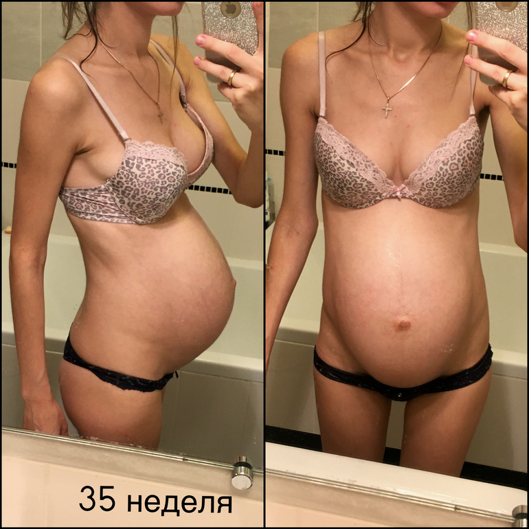 Беременность 36 недель каменеет. 36 Недель каменеет живот. Каменеет живот на 35 неделе. Каменеет живот на 38 неделе беременности.
