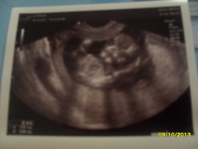 Первый скрининг!