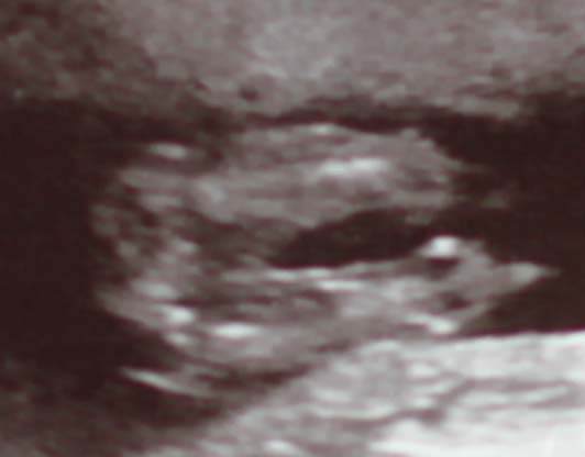 сказали на 99% девочка