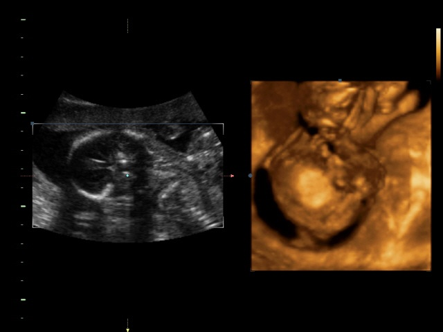 Итааак, у нас будет...