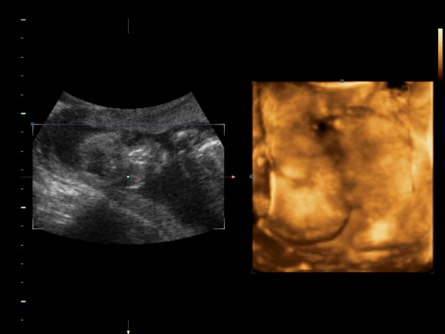 Итааак, у нас будет...