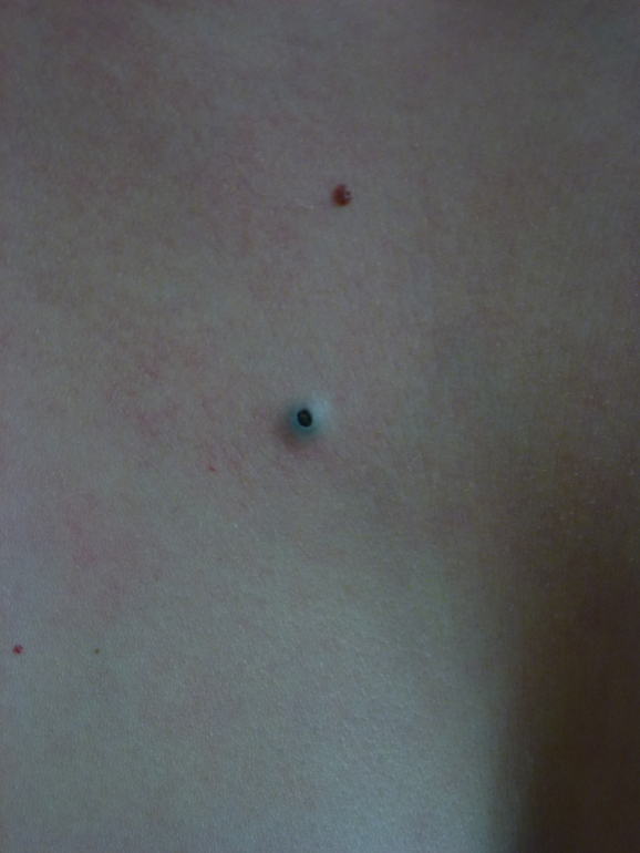 давно это пятнышко, врачи не знают что это