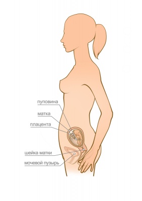 Крепление плода к передней стенке матки особенности