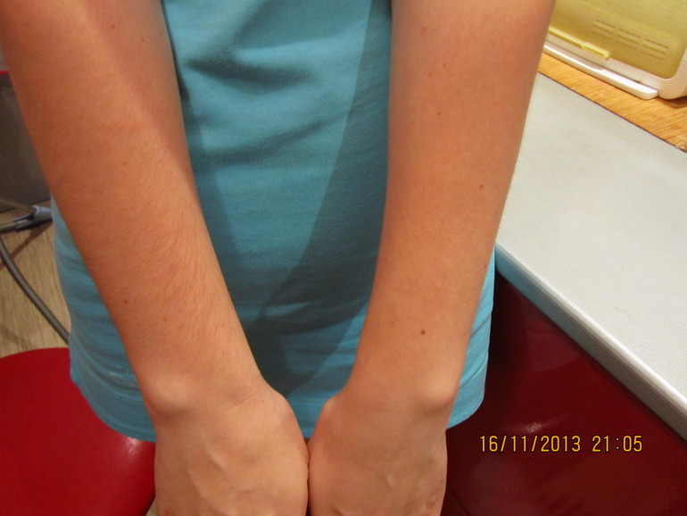 Удаляем над губой.....))))