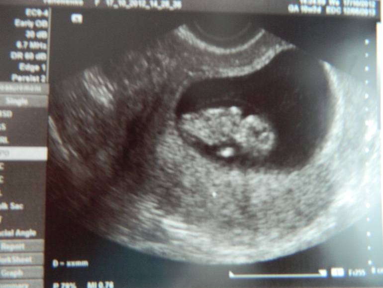 Для ВАС, дорогие, заразные вещицы))))