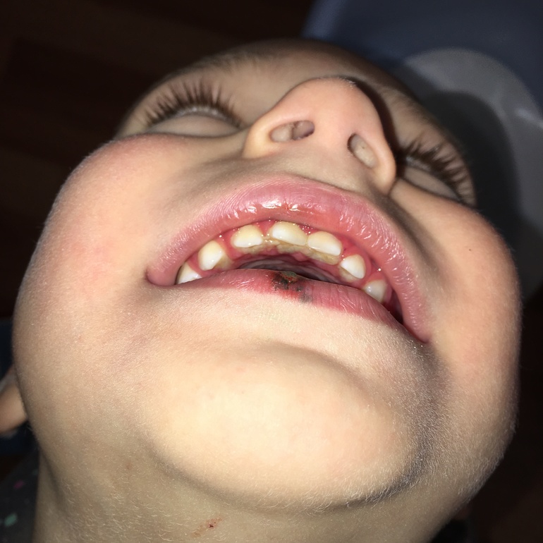 фото заднего прохода у ребенка