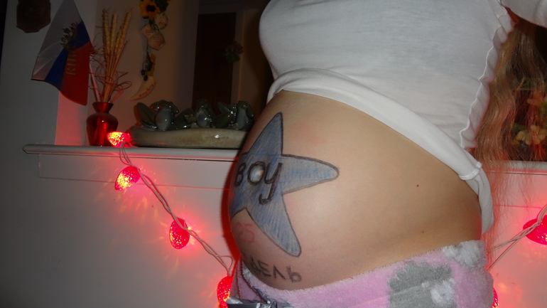 Плановое УЗИ на 25 недельке