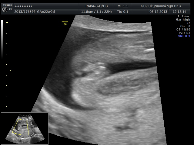 Наша умничка!!! ( немного фото)