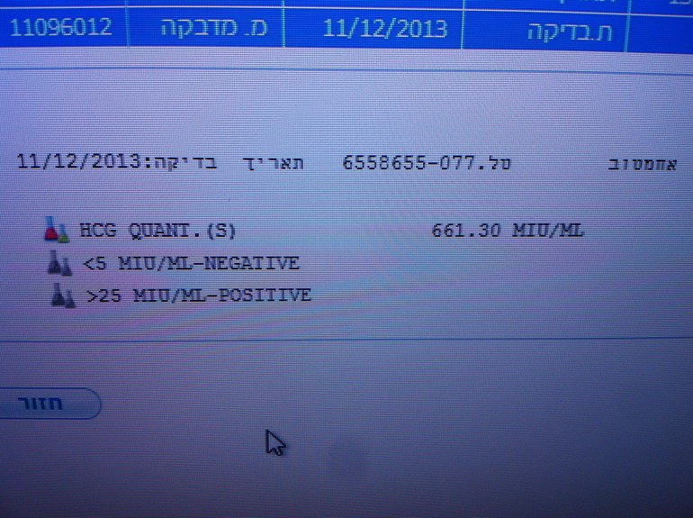 Чудеса случаются! :)