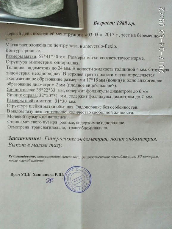 Возможна ли беременность при полипе эндометрия отзывы врачей