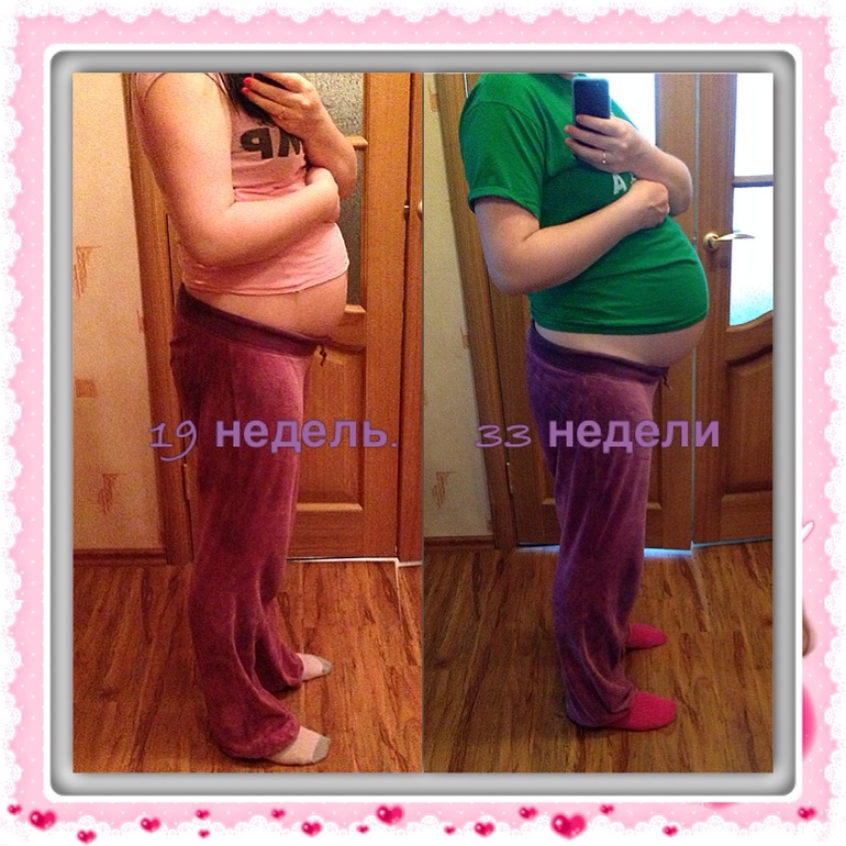 33 недельки