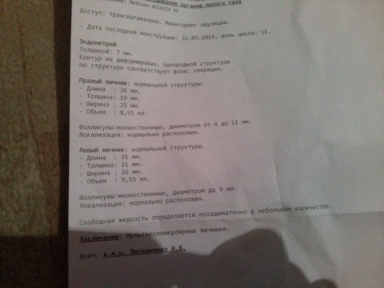 печальбеда(((