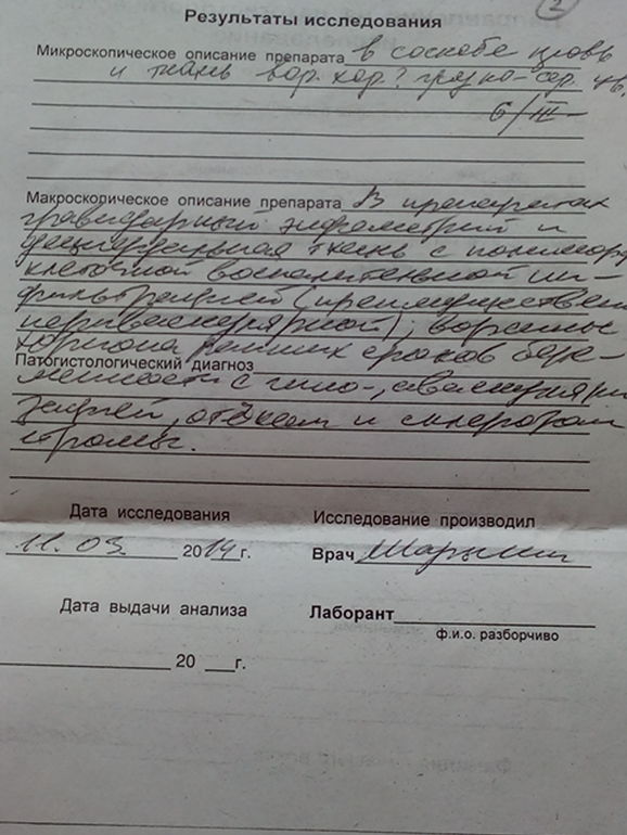результаты гистологии!