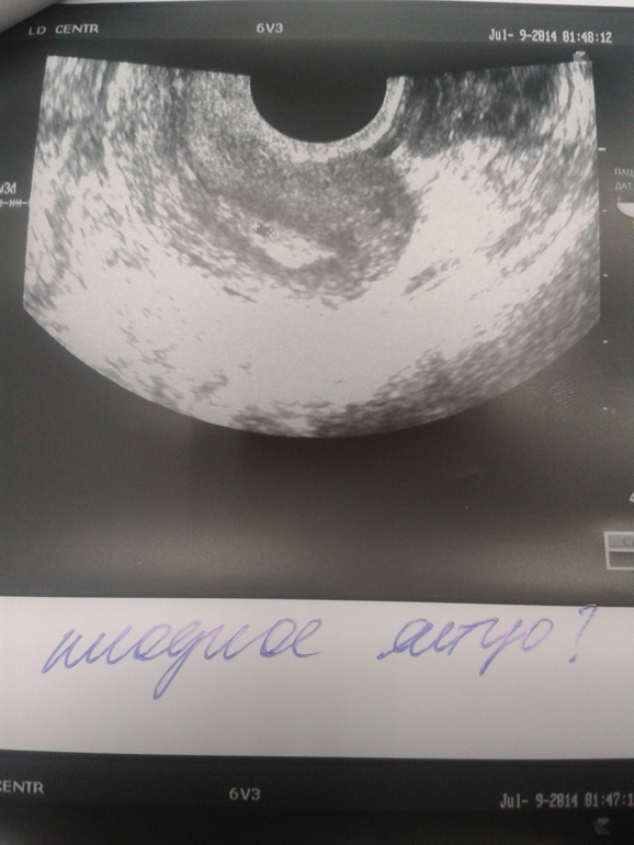 Я в шоке! Результаты УЗИ — 114 ответов на Babyblog