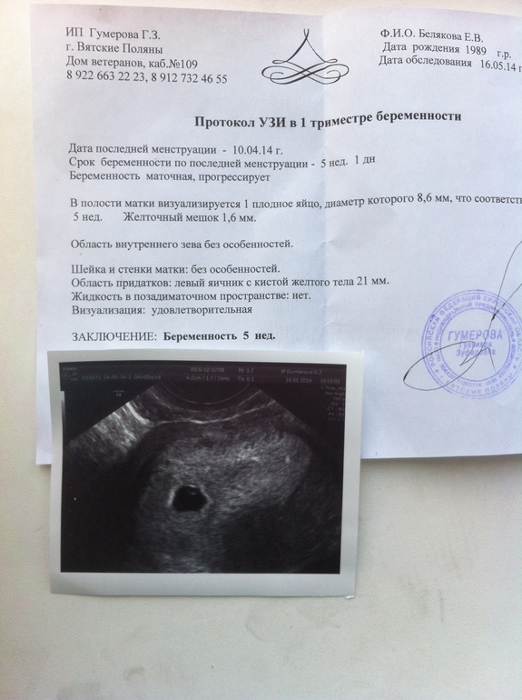 Моя бусинка)) ттт все хорошо!!!