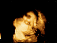 Фото УЗИ на 35 неделе беременности