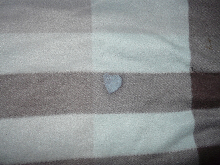 4 месяца, Волосенька.