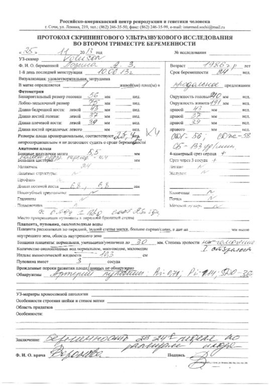4D узи на 25 неделе))))