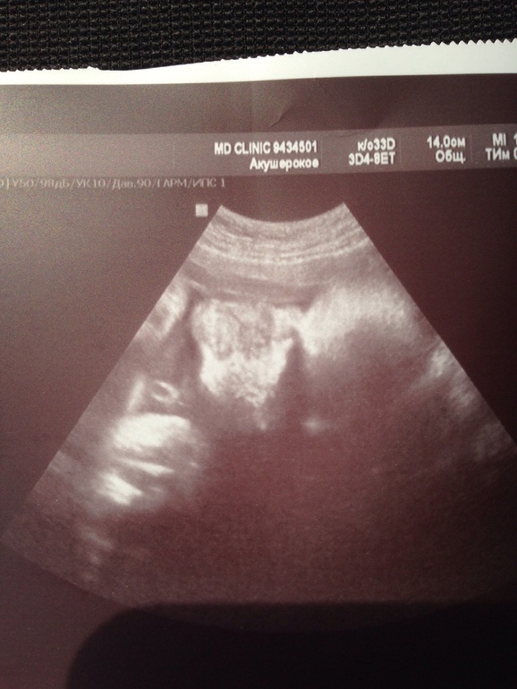 Отчет о нашей 35-36 недельке!!!