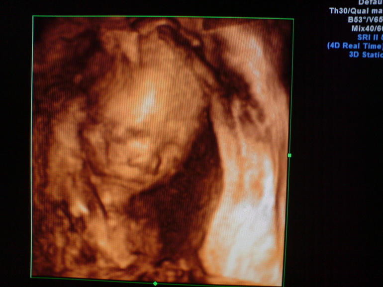 полноценная встреча с моим чудом №2