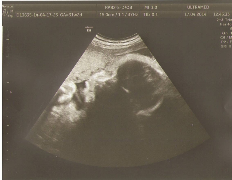 Как мы прожили эту недельку +УЗИ