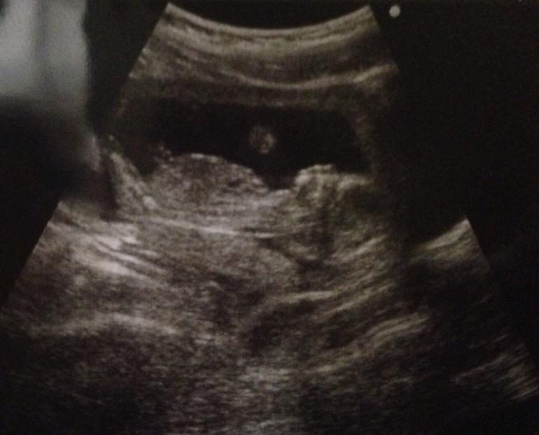 Мои 14,6)) и кто там у нас????